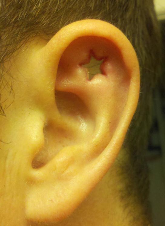 Die besten 100 Bilder in der Kategorie piercing: Sternchen-Ohr