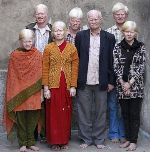 Die besten 100 Bilder in der Kategorie menschen: Indian Albino Family
