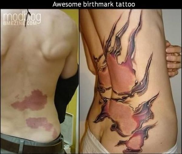 Awesome Birthmark Tattoo 