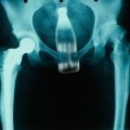 Die besten Bilder in der Kategorie peinlich: Cola-Flasche im Arsch - Röntgenbild
