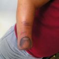 Die besten Bilder in der Kategorie lustige_tattoos: Fingernagel-Tattoo auf Arm-Stumpf - Riesenfinger