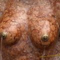 Die besten Bilder in der Kategorie kunst: Melanoma Fountain - Female Breast Fountain