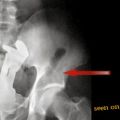 The Best Pics:  Position 38 in  - Toy in After - X-Ray Image