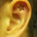 The Best Pics:  Position 12 in  - Star Ear