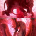 Die besten Bilder in der Kategorie tiere: Elefanten-Embryo und Delfin-Embryo Foto