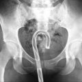 The Best Pics:  Position 34 in  - Anal-Accident, Walking Stick, X-Ray