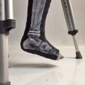 The Best Pics:  Position 19 in  - x-ray, cast, shoe