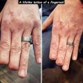 The Best Pics:  Position 6 in  - Fingernail, tattoos, amputation, phalanx, deception