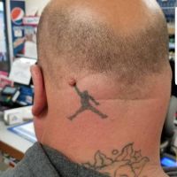 Furunkel, Auswuchs, Tattoo, basketball, dunking, funny